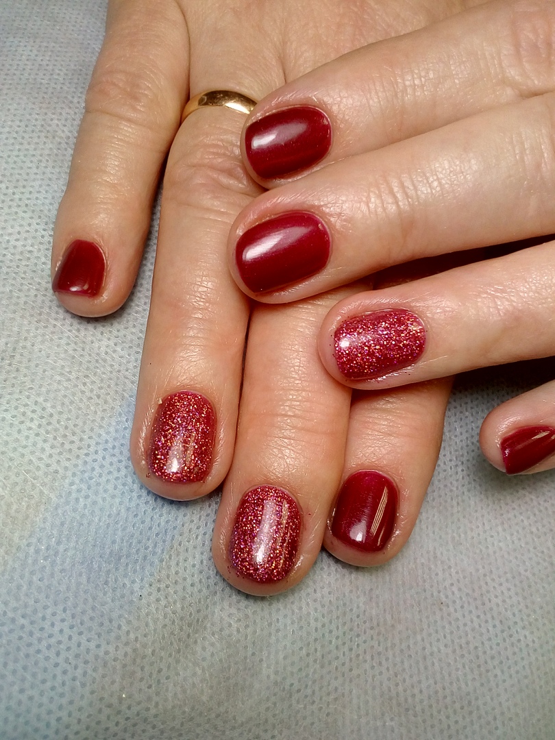 синегнойная палочка псевдомония. синегнойная псевдомония. псевдомония синегнойная палочка это на ногтях. синегнойная псевдомония. синегнойная палочка псевдомония.