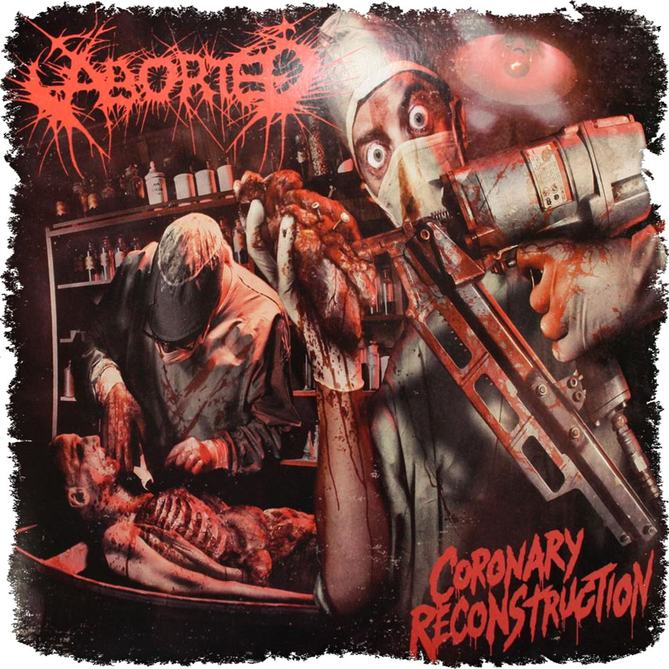 Aborted - Coronary Reconstruction (EP)