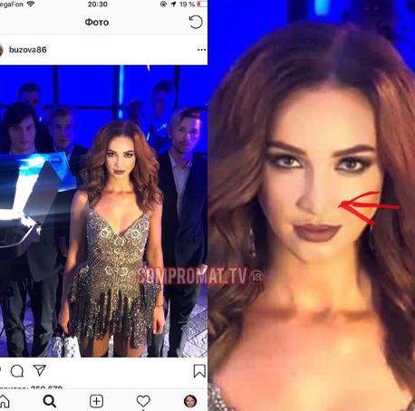 У Ольги Бузовой пропала ноздря благодаря фотошопу.