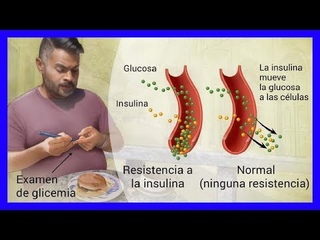 20 Comidas que los Diabéticos deben Evitar por Completo - Muchas de ellas las Consumes a Diario