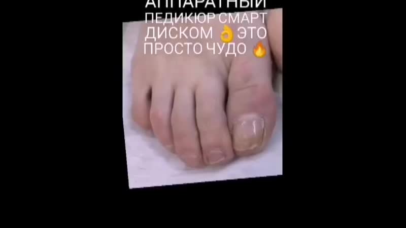 VID_76101030_173203_358.mp4