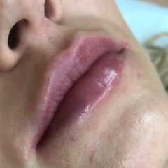 cosmetolog_antonina video
