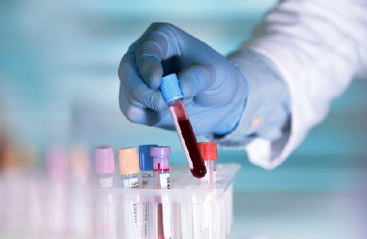 Создан новый метод диагностики рака легких на самых ранних стадиях развития Создан новый метод диагностики рака легких на самых ранних стадиях развития
