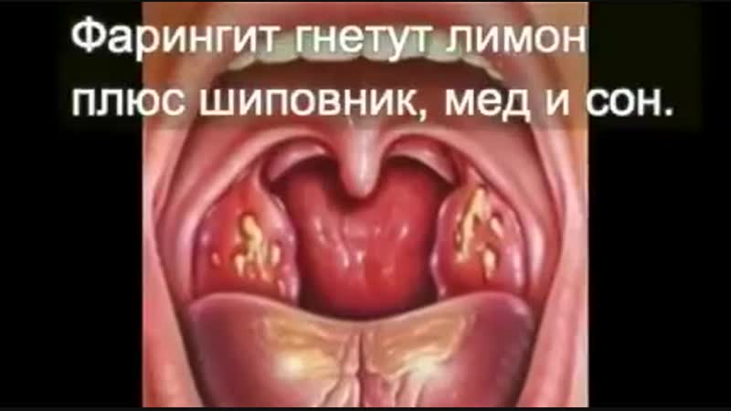 UID2695_1543124769_96.mp4