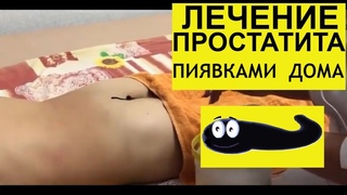 Лечение простатита. Как поставить пиявки в домашних условиях?
