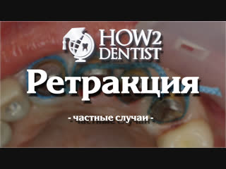 Как выполнить ретракцию при над и поддесневом препарировании / How to dentist
