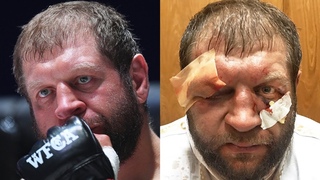 Александр Емельяненко до и после боя против Тони Джонсона / Полный обзор боя