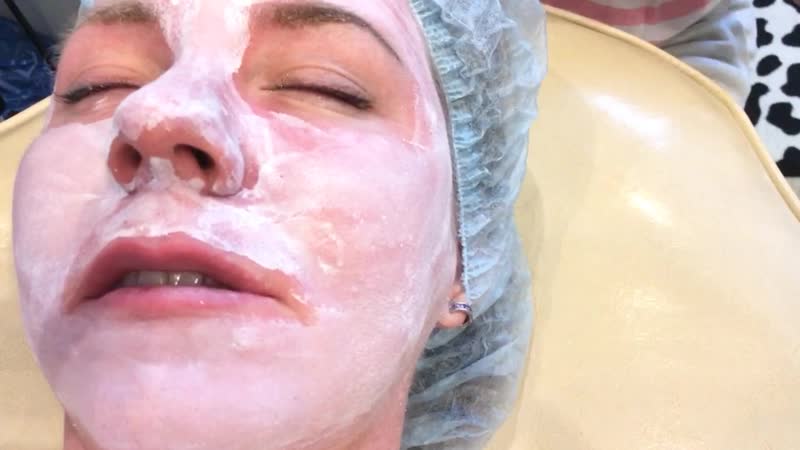 пилинг ТСА 25 skinproject nanopeel