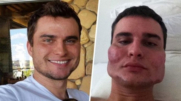 Хирург так улучшил внешность 40 пациентов, что теперь на них печально смотреть. В Бразилии судят хирурга, который, не имея должной квалификации, так улучшил внешность 40 пациентов, что