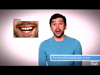 Идеальная улыбка за 649 гривен! Акция Perfect Smile Veneers - 50%