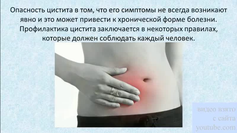 профилактика цистита