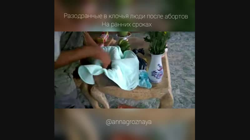 хирургические и вакуумные аборты