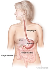 Stomach Cancer Simplified
