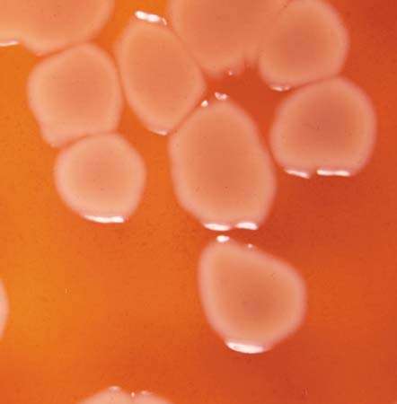 Бактерии, такие как Pseudomonas aeruginosa, могут вызывать инфекции мочеиспускательного канала и мочевого пузыря. Эти инфекции встречаются чаще у женщин, чем у мужчин, и обычно связаны со значительной болью и дистрессом.