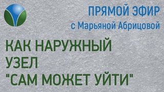 Как наружный узел