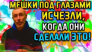 ОНИ СДЕЛАЛИ ЭТО И МЕШКИ ПОД ГЛАЗАМИ ИСЧЕЗЛИ! Островский. Пиелонефрит, сердечные отеки, шафран почки