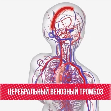 Smirnov_doctor video
