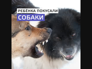 В Подмосковье стая собак покусала школьника