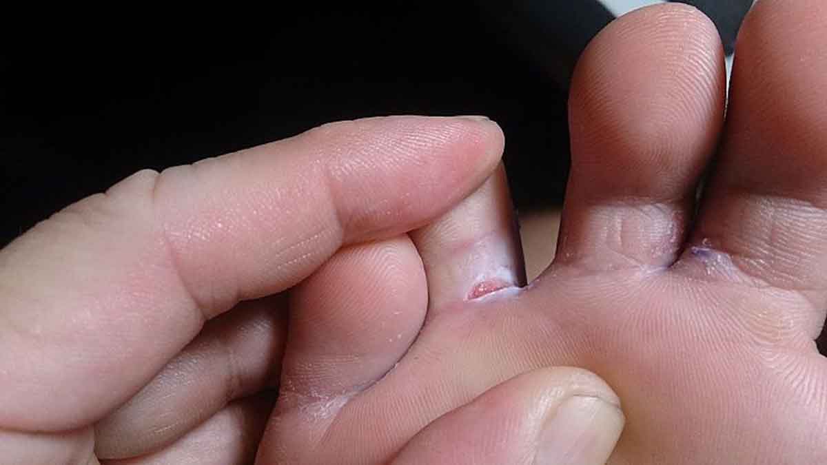 Нога спортсмена Нога спортсмена