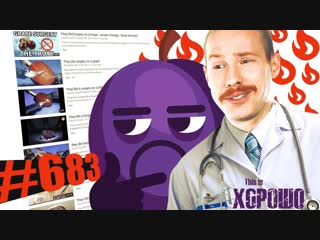 This is Хорошо - ОНИ ПРООПЕРИРОВАЛИ ВИНОГРАДИНКУ!!!! #683