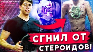 КАЧОК СГНИЛ ОТ СТЕРОИДОВ! НАСТОЯЩАЯ ЖЕСТЬ! НЕОБРАТИМЫЕ ПОСЛЕДСТВИЯ