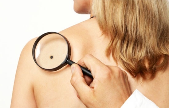 20-24 мая  2019 – дни диагностики рака кожи