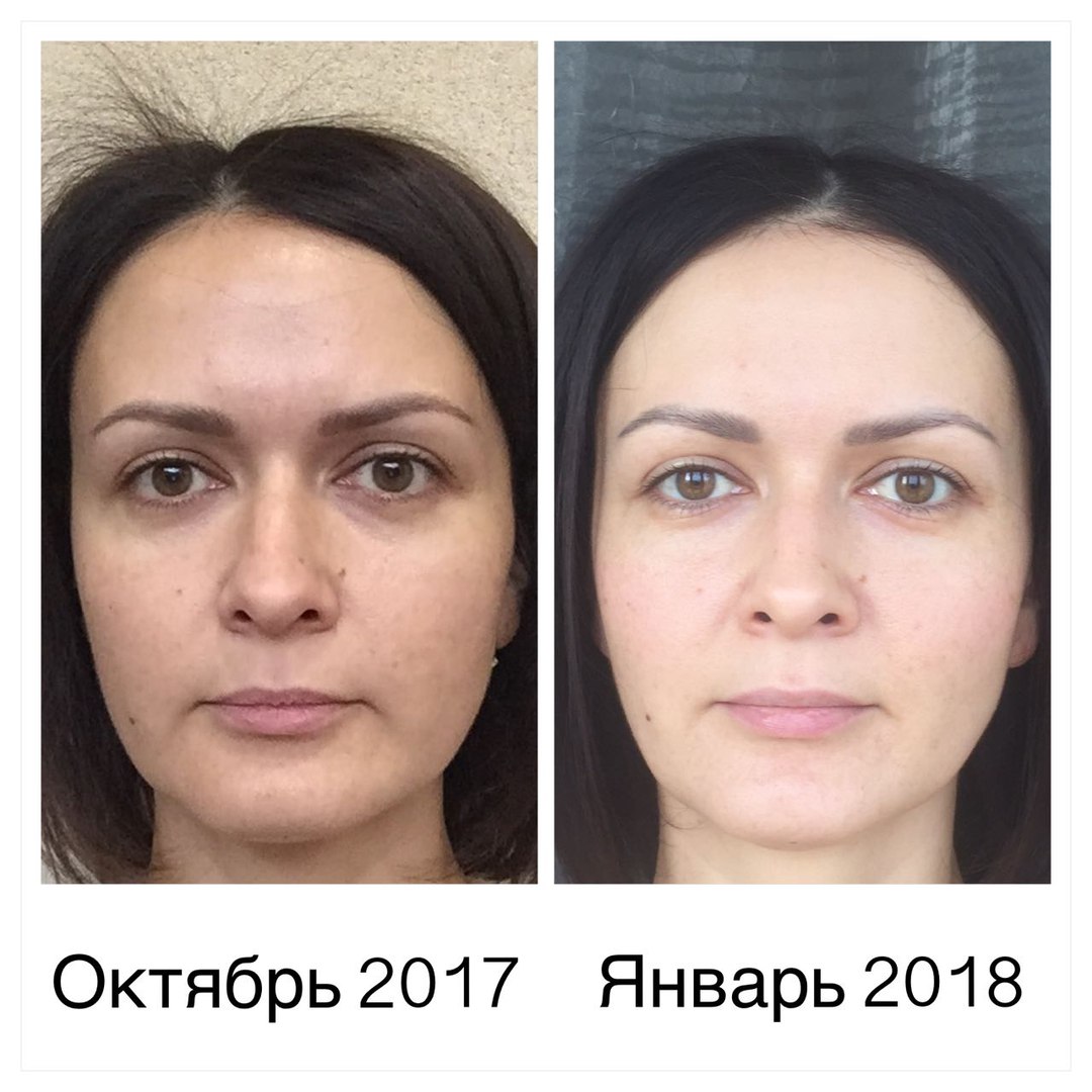 Фейсфитнес идеальное лицо за 10