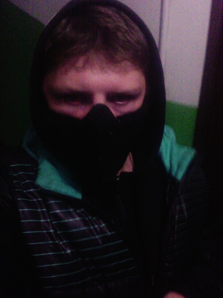 Шрам иркутск. Шрам иркутск